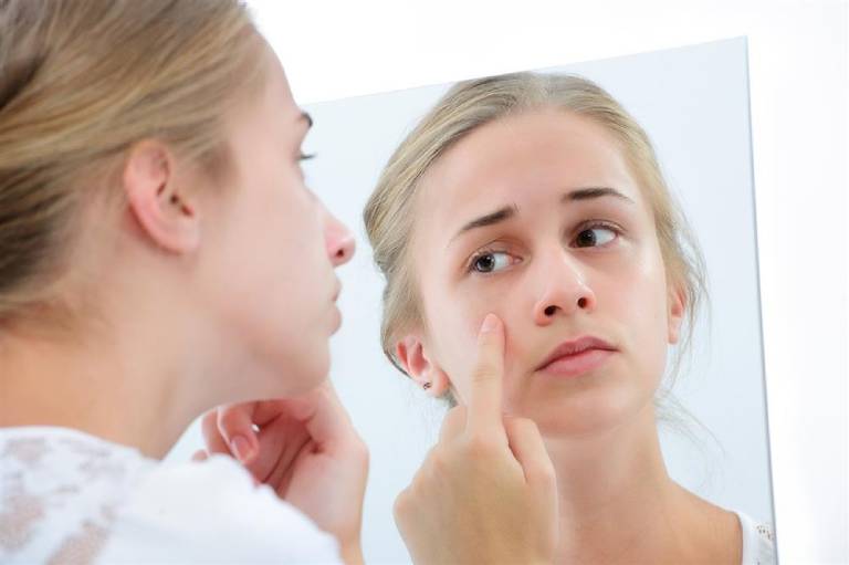 Top 10 cách chữa trị dị ứng da mặt tại nhà, đơn giản, nhanh khỏi